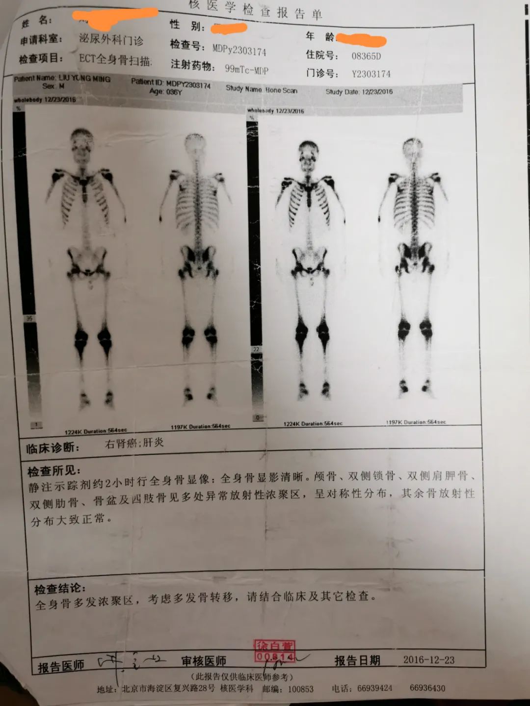 一位MDS伴MF病友心路历程
