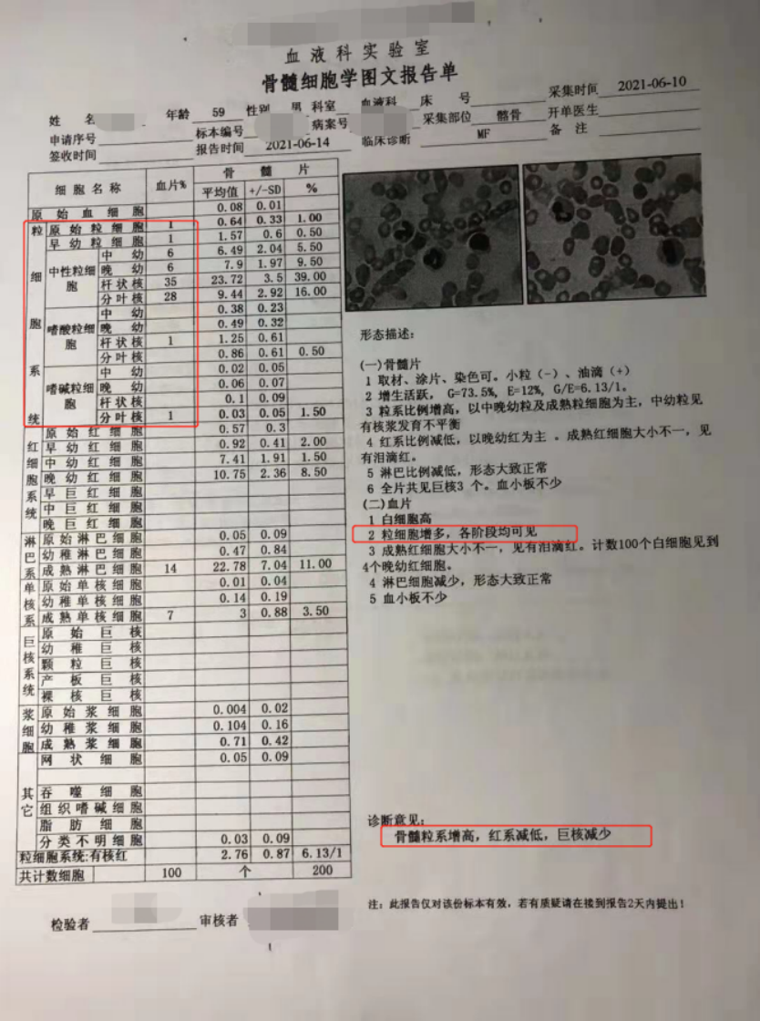 这样看骨穿报告,医生懂得您也懂