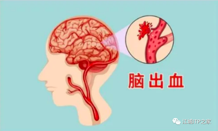 一问医答 | 原发免疫性血小板减少症(ITP)常见问题