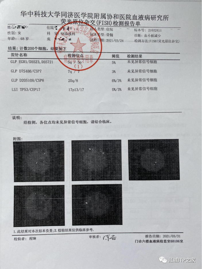 大咖谈病例 | 梅恒教授点评—肿瘤化疗后血小板减少症(CIT)病例解析