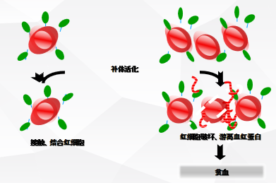 大咖零距离|周虎教授谈阵发性睡眠性血红蛋白尿症(PNH)