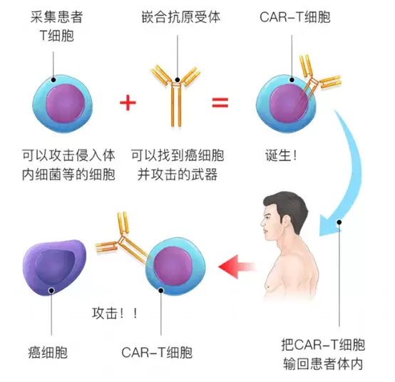 百万起步,CAR-T到底是何方神药?凭什么这么贵?疗效怎样? 百万起步,CAR-T到底是何方神药?凭什么这么贵?疗效怎样?