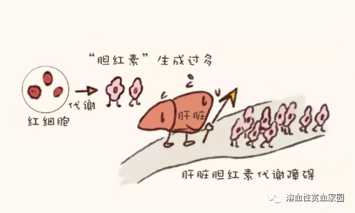 科普时间 | 溶血性贫血,怎么去黄?