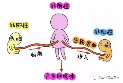 科普时间 | 溶血性贫血,怎么去黄?