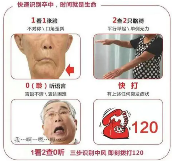 科普时间 | MPN患者面对卒中风险,如何防范?