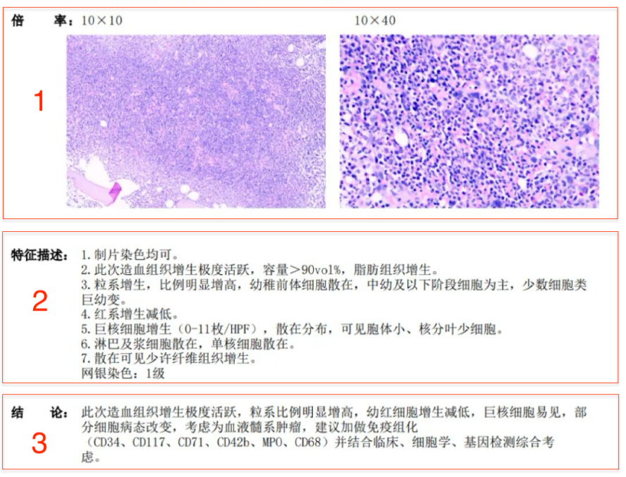 认识检查 | 骨髓活检报告如何看?