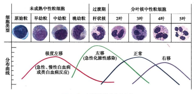认识检查 | 骨髓活检报告如何看?