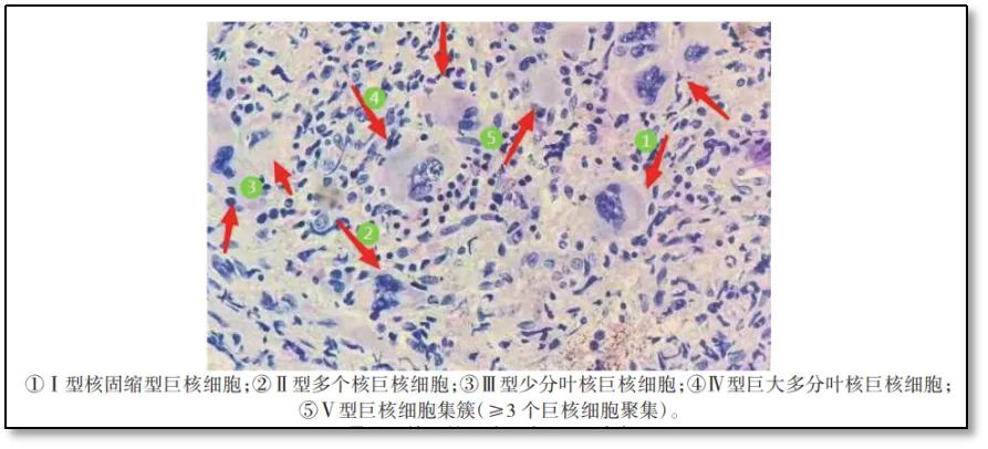 Q&#038;A | 有图有真相，骨髓活检报告应该这样看！