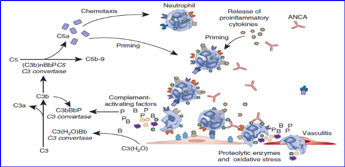 宫玉芳教授剖析:ANCA血管炎的发病机制