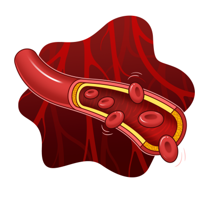 科普时间 | 现代医学也“放血”?揭秘真性红细胞增多症的“放血疗法”