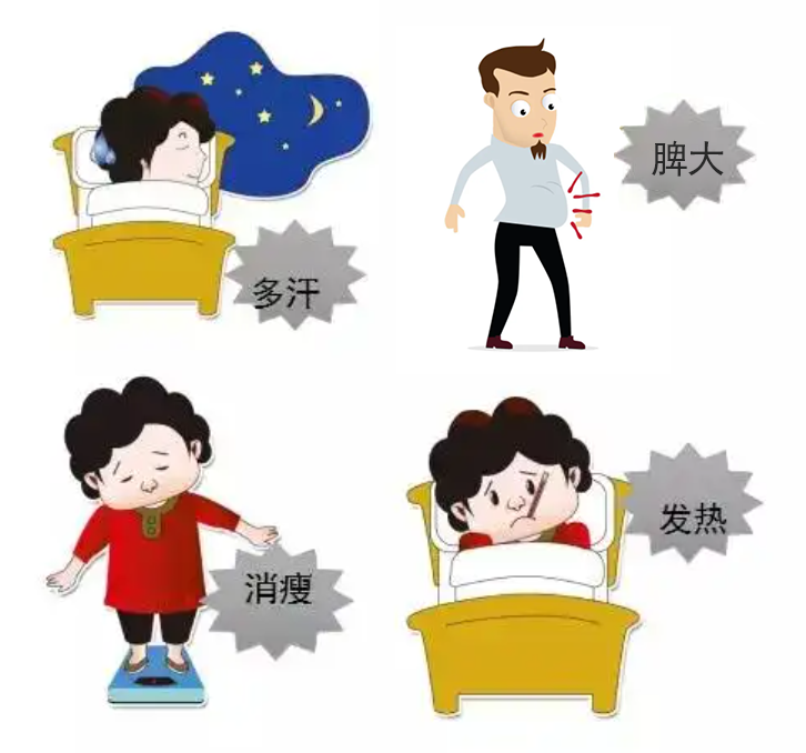 Q＆A | 原发性血小板增多症进展为骨髓纤维化，如何识别？