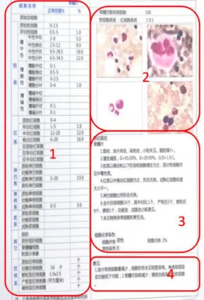 认识检查 | 正确解读“生命说明书”,手把手教你看骨髓穿刺报告!