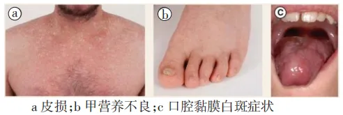 认识疾病 | 先天性角化不良和再生障碍性贫血究竟有何关联?密不可分!