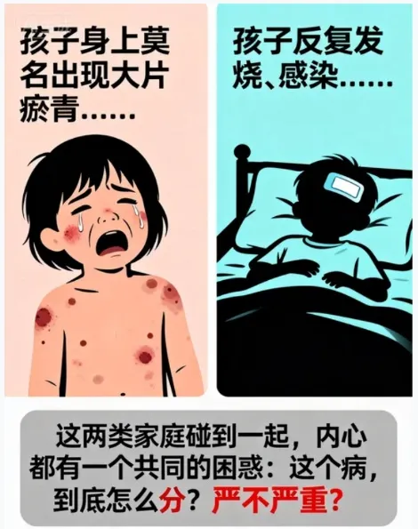 科普时间 | 孩子莫名瘀青、反复发烧？别慌！一篇文章讲透儿童再障
