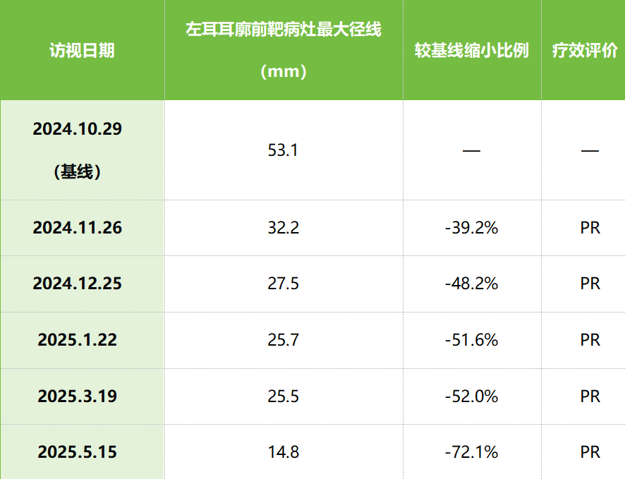 一例8岁NTRK重排梭形细胞肿瘤多次复发后经ICP-723治疗的临床突破