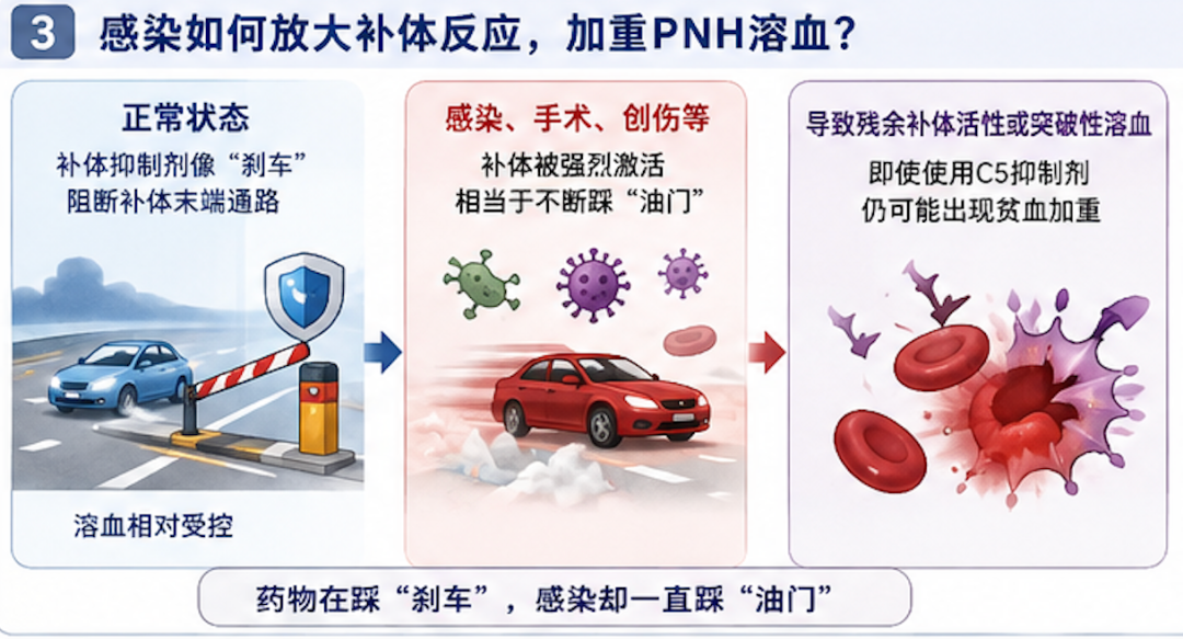病例分享 | 用了补体抑制剂，PNH患者贫血为什么还在加重？答案可能藏在反复流脓的牙齿里