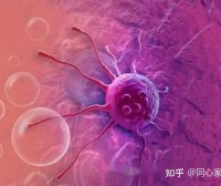 急性髓系白血病诊治进展变化多