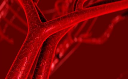 原发性血小板增多症