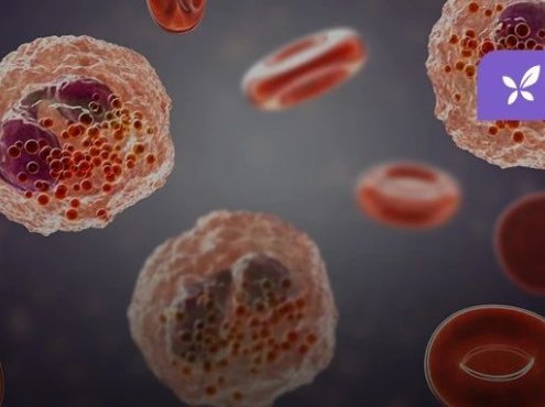 嗜酸性粒细胞增多的 10 大原因,最后一种很容易误诊!