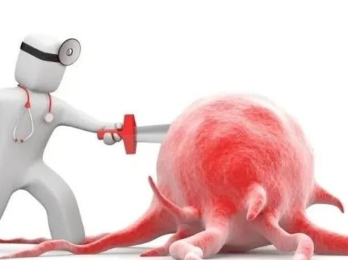 一文了解多发性骨髓瘤