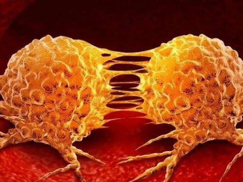 非霍奇金淋巴瘤是十大恶性肿瘤之一?罪魁祸首在这里!