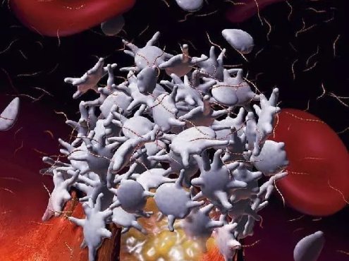 复发/难治性血栓性血小板减少性紫癜的诊治进展