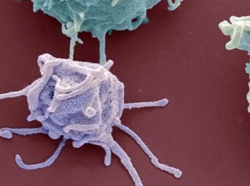 血栓性血小板减少性紫癜(TTP)最新指南(2022版),这些要点您不可不知!