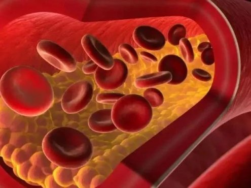 全面认识弥散性血管内凝血