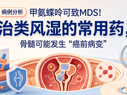 病例分析 | 甲氨蝶呤可致MDS!治类风湿的常用药,骨髓可能发生“癌前病变”